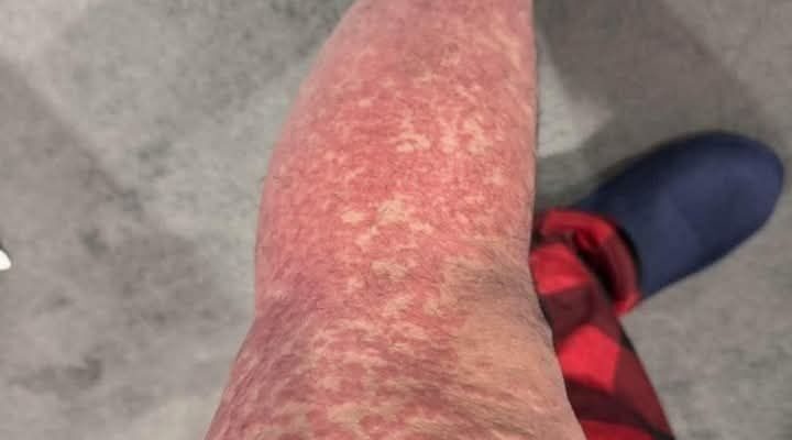 These are the consequences of sleeping with…See more